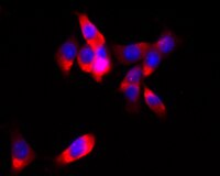 MC38 Murine Colon Adenocarcinoma Cell Line | SCC172